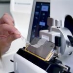 Novo edital do IgesDF mira avanço em exames da rede pública