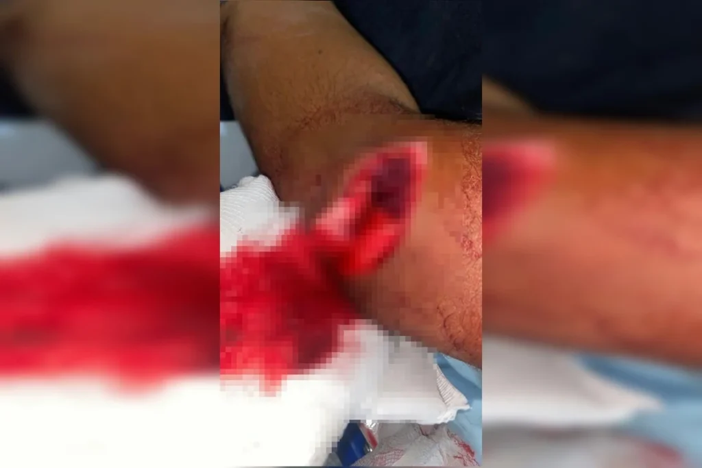 Homem é preso após tentar decepar cabeça de rival em briga no Entorno do DF. Veja vídeo