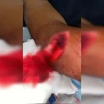 Homem é preso após tentar decepar cabeça de rival em briga no Entorno do DF. Veja vídeo