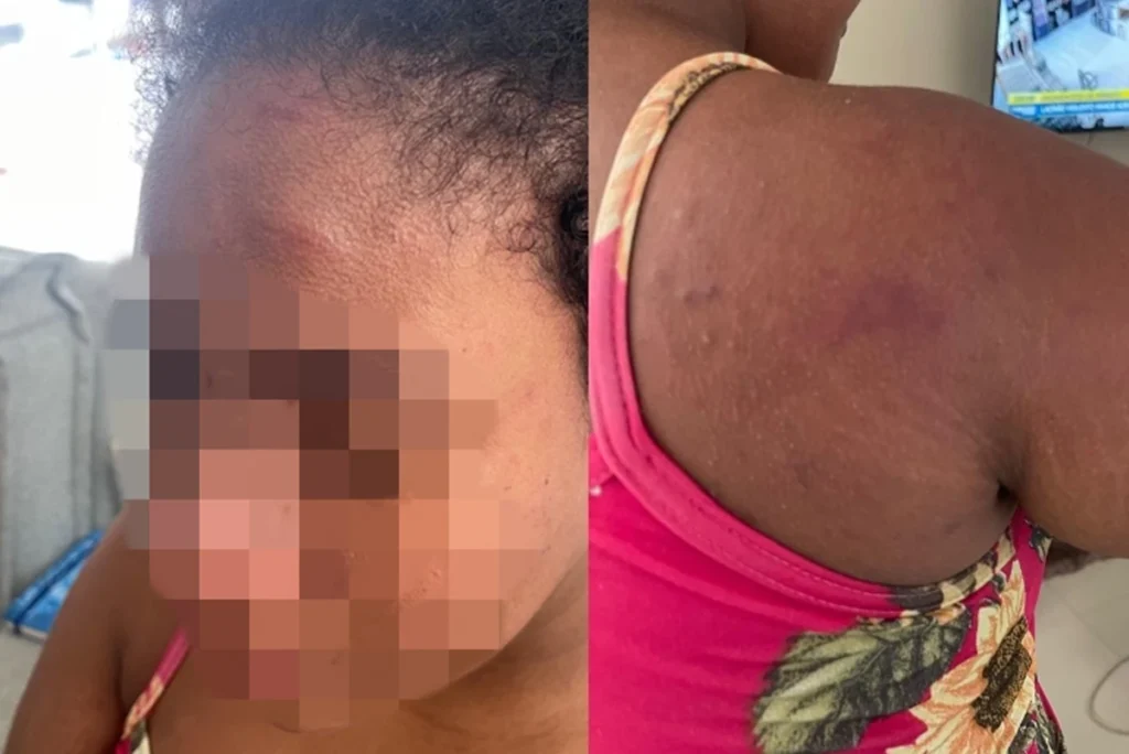 Doméstica grávida agredida por patroa foi arrastada pelos cabelos