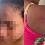 Doméstica grávida agredida por patroa foi arrastada pelos cabelos