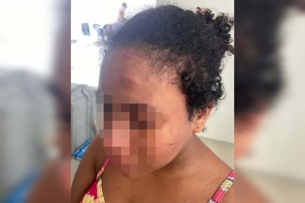 “Achei que ia morrer”, diz doméstica grávida agredida por patroa no MA