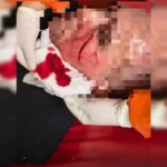 Policial militar é ferido no rosto durante ocorrência de violência doméstica no DF