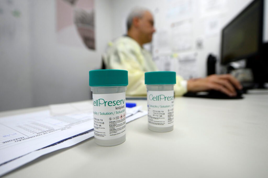 DF avança na prevenção do câncer do colo do útero com a implantação do teste de DNA-HPV na rede pública